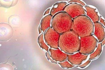 美国做试管婴儿生多胎费用要多少钱？3万美元够吗？